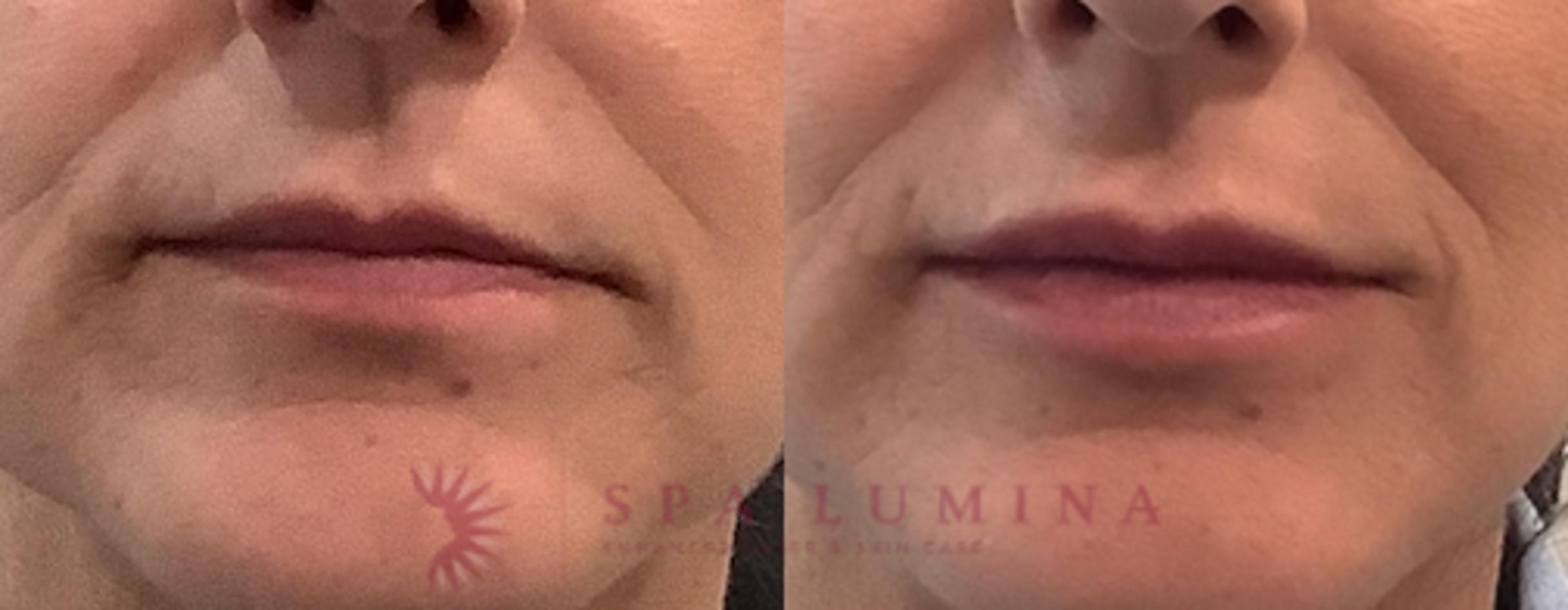 Inital Treatment
